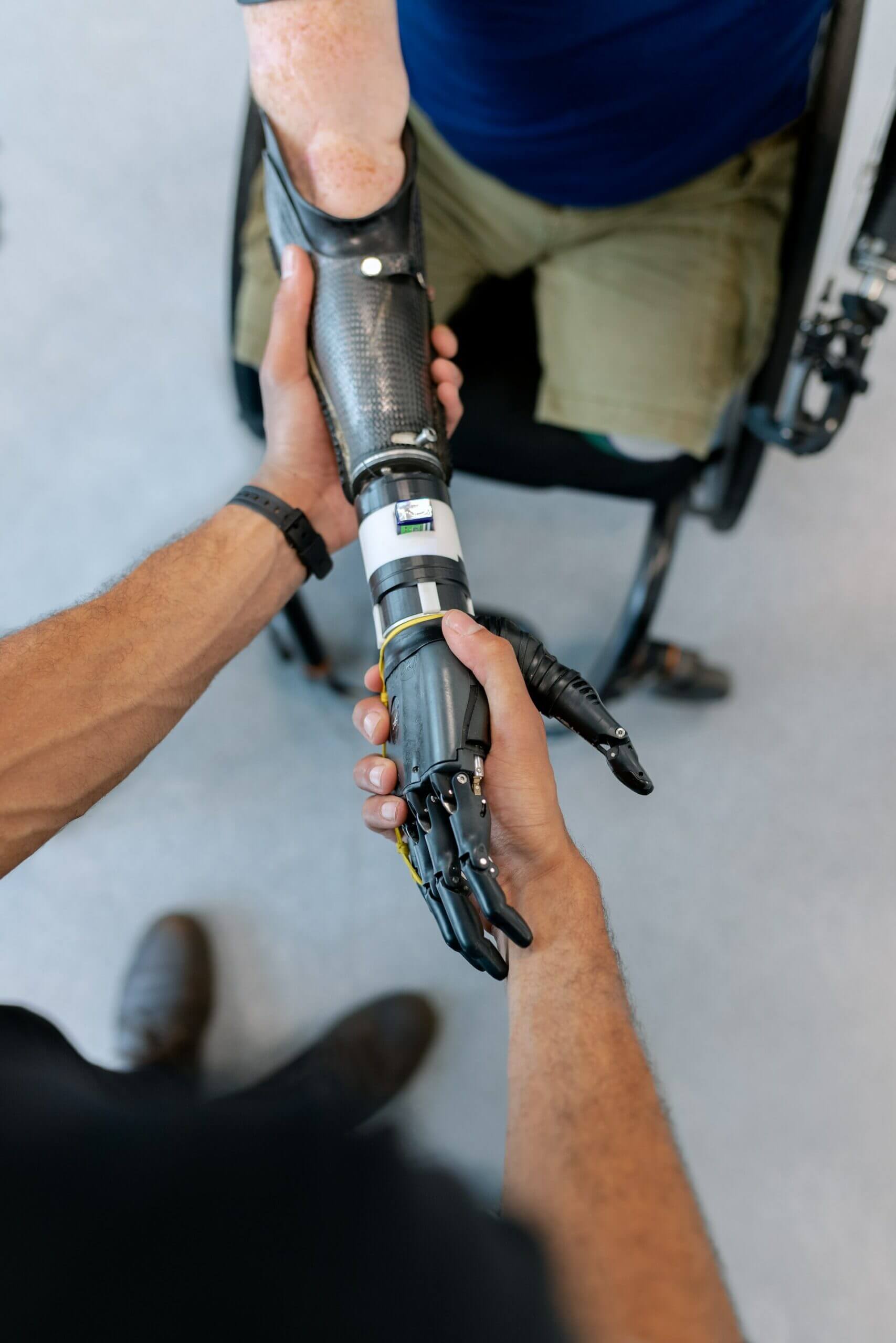 Amputee being fitted a robotic hand